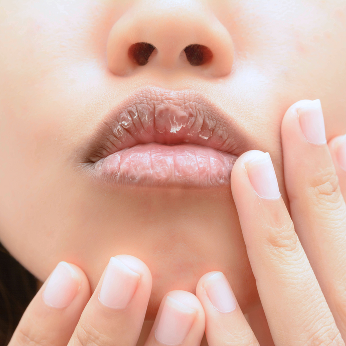 How To: Banish Dry Lips, Forever!